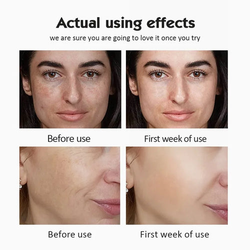 FreestyleCrown 20% Vitamin C Ampoule Serum Set  Moisturising Whitening Wrinkle Reducing Anti-Ageing Serum Face Beauty Skin Care